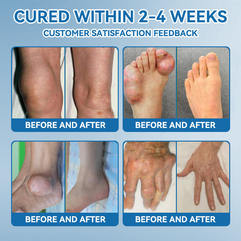 ๐ช๐๐๐๐ข๐๐ข๐๐ฅ ๐ฌ๐ญ๐จ๐ซ๐ |๐ฉ๐๐-๐๐๐ ๐๐จ๐ข๐ง๐ญ ๐๐๐๐ฅ๐ข๐ง๐ ๐๐ซ๐๐๐ฆ๐ฆด๐๐ซ๐๐๐ญ๐ฌ ๐๐ซ๐ญ๐ก๐ซ๐ข๐ญ๐ข๐ฌ, ๐๐๐ฎ๐ซ๐จ๐ฉ๐๐ญ๐ก๐ฒ, ๐๐ก๐๐ฎ๐ฆ๐๐ญ๐ข๐ฌ๐ฆ, ๐๐ฉ๐จ๐ซ๐ญ๐ฌ ๐๐ง๐ฃ๐ฎ๐ซ๐ข๐๐ฌ & ๐๐จ๐ซ๐ ๐ช