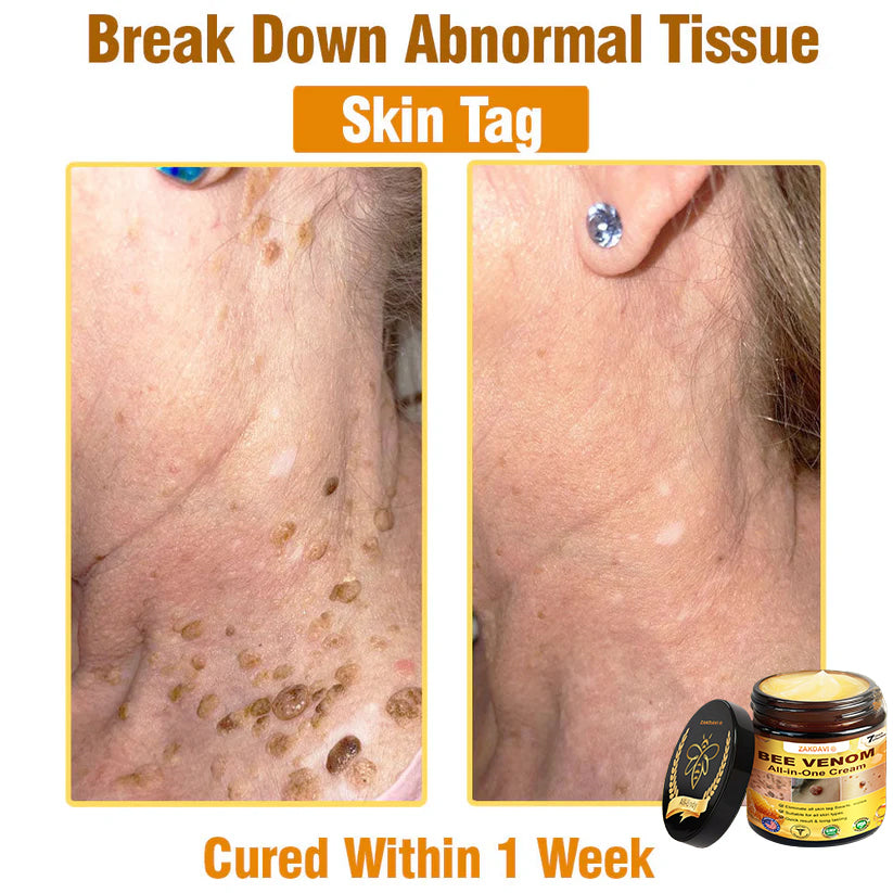 ZAKDAVI™ Bee Venom All-in-One Cream US Dermatologist Approved-