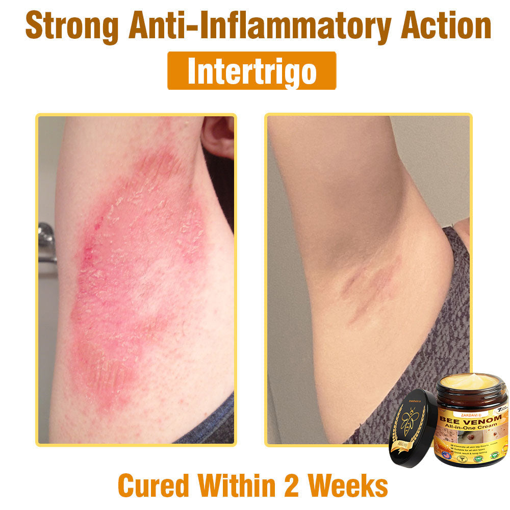 ZAKDAVI™ Bee Venom All-in-One Cream US Dermatologist Approved-