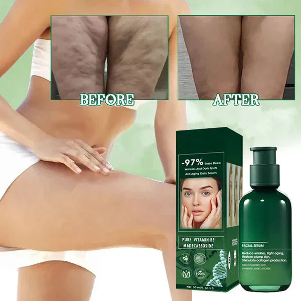 π₯π©ββοΈLast Day Promotion ππ%ππ
π
- SkinFirming Rejuvenating Serumπ₯