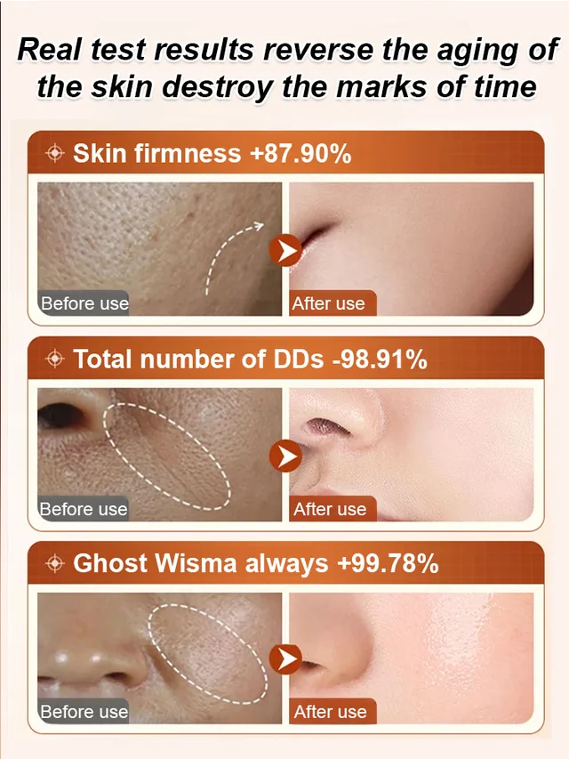 š„BUY 1 GET 1 FREEš„Ecdoin anti aging essence