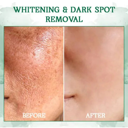 π₯π©ββοΈLast Day Promotion ππ%ππ
π
- SkinFirming Rejuvenating Serumπ₯