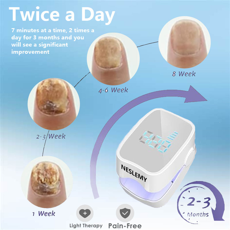 🔥(Official Mall)🔥NESLEMY Nail Fungus cleaning Light Device-🗽Made and Shipped from USA 🔥