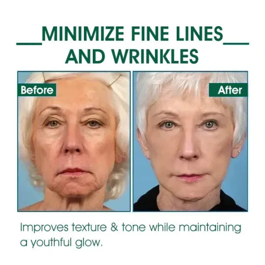 π₯π©ββοΈLast Day Promotion ππ%ππ
π
- SkinFirming Rejuvenating Serumπ₯