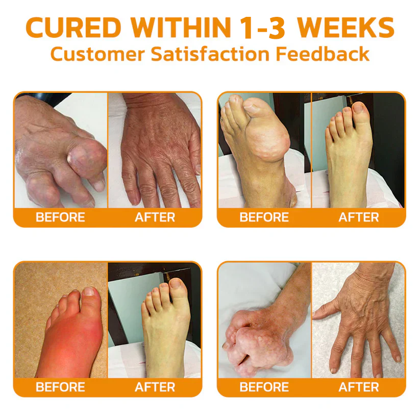 🎁✅Official Store BUY 2 GET 1 FREE: flysmus™ Lidocaine Scar-Free Pain Relief Healing Liquid👨⚕️USA Osteopathic Medical Association (AAOS)Approved(Reducing joint swelling, pain, stiffness, redness, warmth, soreness and joint fatigue )