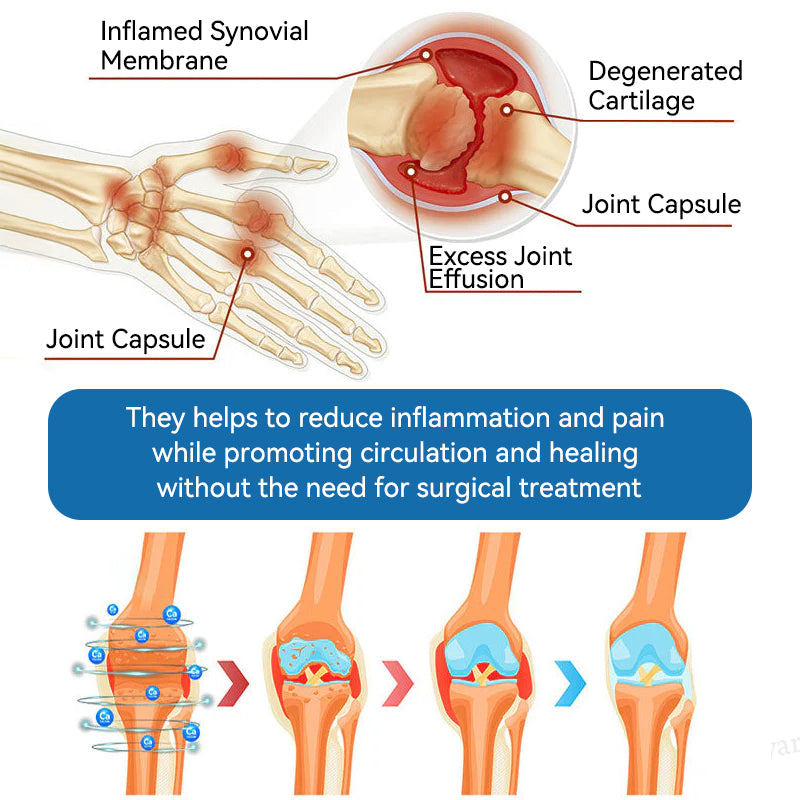 💪𝐎𝐟𝐟𝐢𝐜𝐢𝐚𝐥 𝐬𝐭𝐨𝐫𝐞 |𝑩𝐏𝐂-𝟏𝟓𝟕 𝐉𝐨𝐢𝐧𝐭 𝐇𝐞𝐚𝐥𝐢𝐧𝐠 𝐂𝐫𝐞𝐚𝐦🦴𝐓𝐫𝐞𝐚𝐭𝐬 𝐀𝐫𝐭𝐡𝐫𝐢𝐭𝐢𝐬, 𝐍𝐞𝐮𝐫𝐨𝐩𝐚𝐭𝐡𝐲, 𝐑𝐡𝐞𝐮𝐦𝐚𝐭𝐢𝐬𝐦, 𝐒𝐩𝐨𝐫𝐭𝐬 𝐈𝐧𝐣𝐮𝐫𝐢𝐞𝐬 & 𝐌𝐨𝐫𝐞 💪