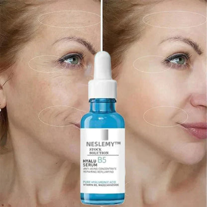 🔥Last Day Promotion 70% OFF🔥-Clostridium botulinum Face Serum