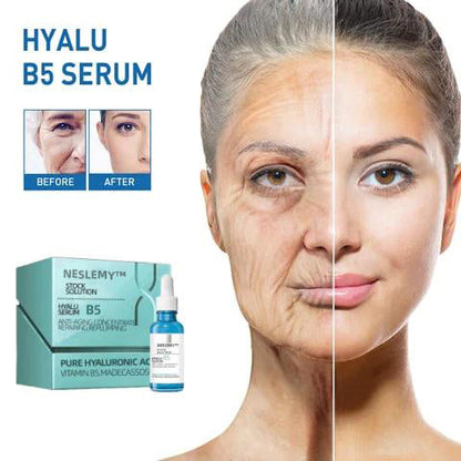 🔥Last Day Promotion 70% OFF🔥-Clostridium botulinum Face Serum