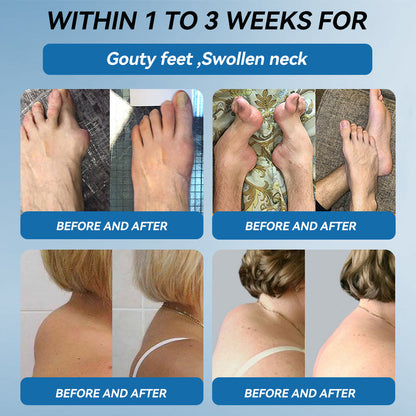 💪𝐎𝐟𝐟𝐢𝐜𝐢𝐚𝐥 𝐬𝐭𝐨𝐫𝐞 |𝑩𝐏𝐂-𝟏𝟓𝟕 𝐉𝐨𝐢𝐧𝐭 𝐇𝐞𝐚𝐥𝐢𝐧𝐠 𝐂𝐫𝐞𝐚𝐦🦴𝐓𝐫𝐞𝐚𝐭𝐬 𝐀𝐫𝐭𝐡𝐫𝐢𝐭𝐢𝐬, 𝐍𝐞𝐮𝐫𝐨𝐩𝐚𝐭𝐡𝐲, 𝐑𝐡𝐞𝐮𝐦𝐚𝐭𝐢𝐬𝐦, 𝐒𝐩𝐨𝐫𝐭𝐬 𝐈𝐧𝐣𝐮𝐫𝐢𝐞𝐬 & 𝐌𝐨𝐫𝐞 💪