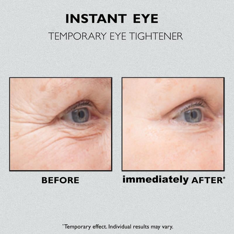 🔥HOT SALE 49% OFF🔥 Lovilds™ Instant Eye Temporary Eye Tightener💕