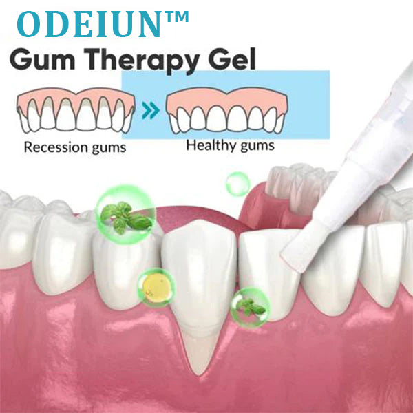 （🔥LAST DAY SALE-80% OFF) ODEIUN™ Gum Therapy Gel